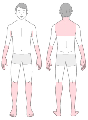 男性用脱毛プラン部位