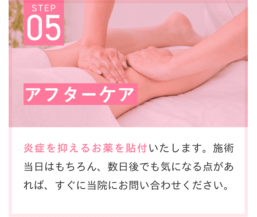 アフターケア