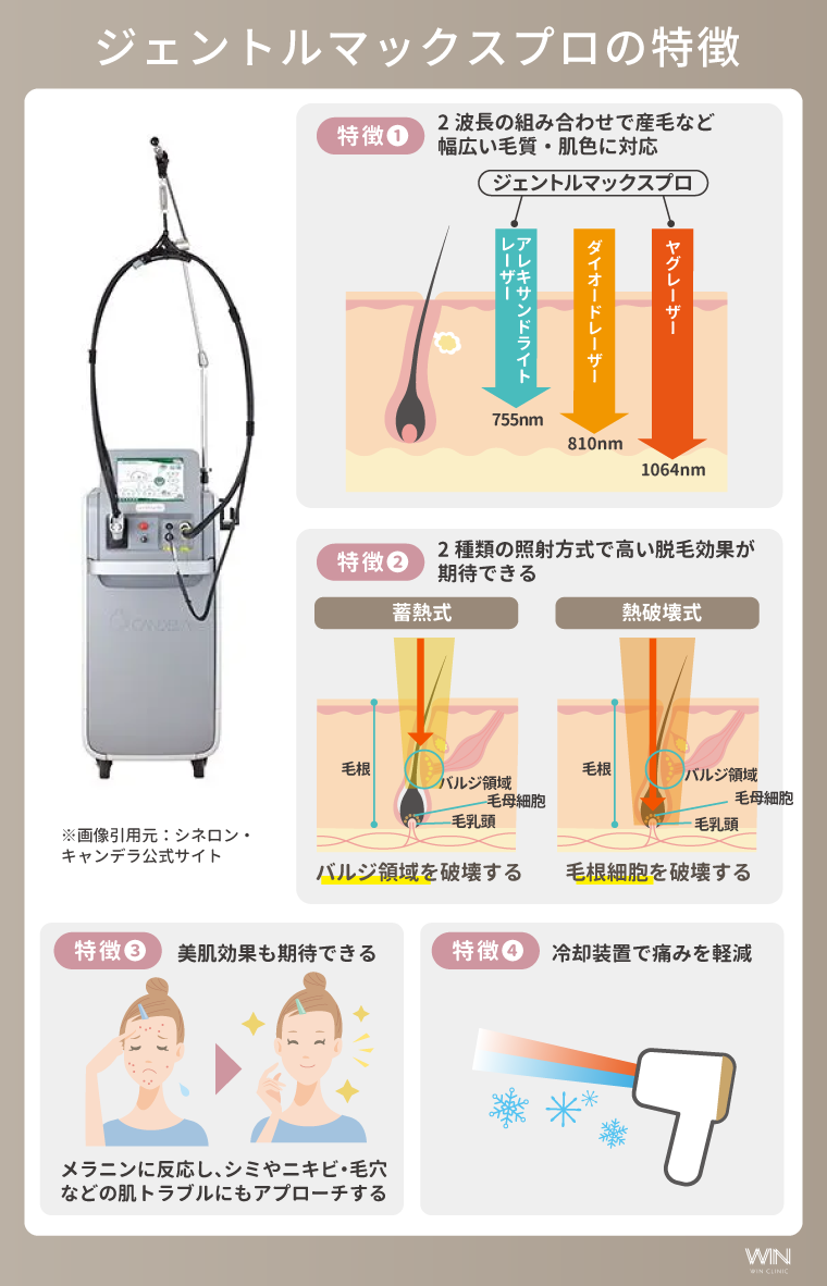 ジェントルマックスプロの特徴
