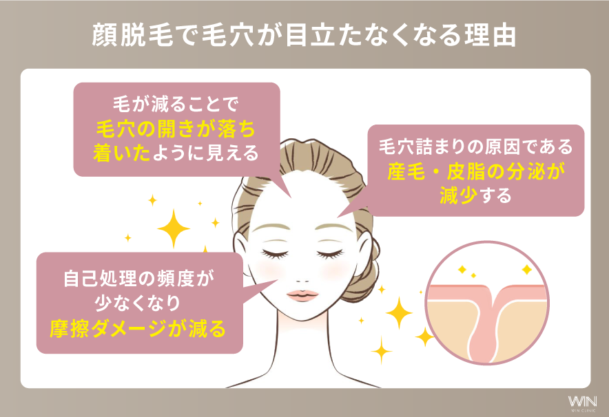 顔脱毛で毛穴が目立たなくなる理由