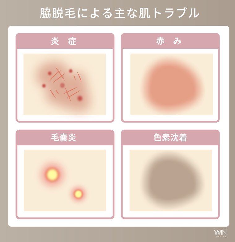 脇脱毛による主な肌トラブル