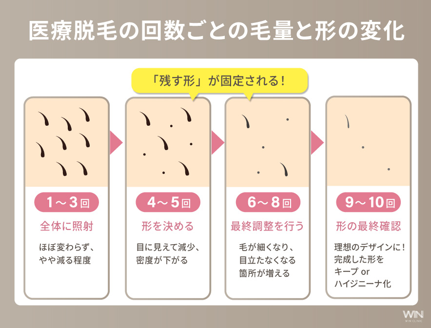 医療脱毛の回数ごとの毛量と形の変化