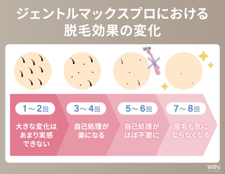 ジェントルマックスプロにおける脱毛効果の変化