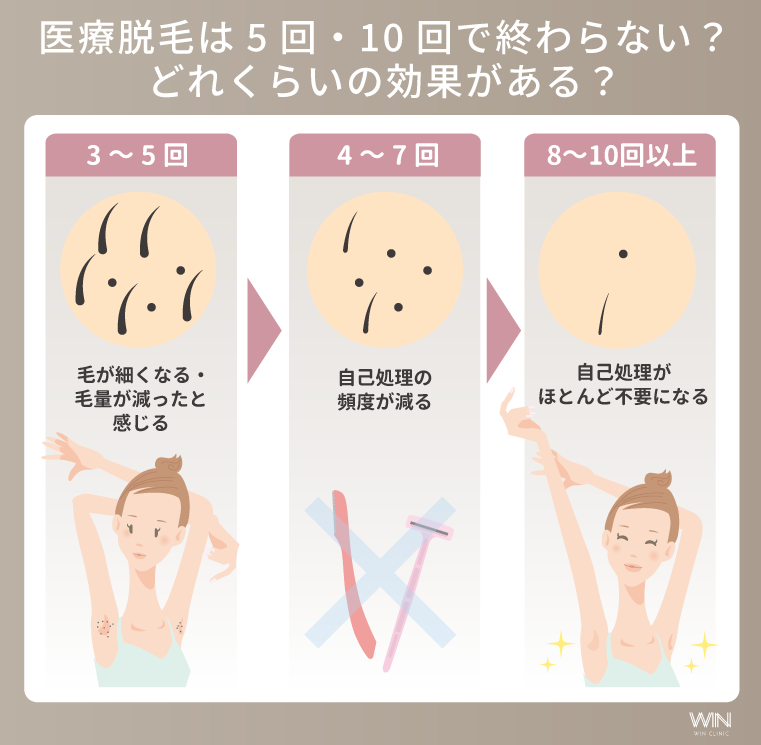 医療脱毛は5回・10回で終わらない？どれくらいの効果がある？