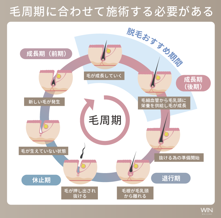 毛周期に合わせて施術する必要がある