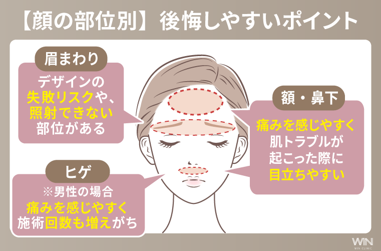 部位別の顔脱毛が後悔しやすい理由