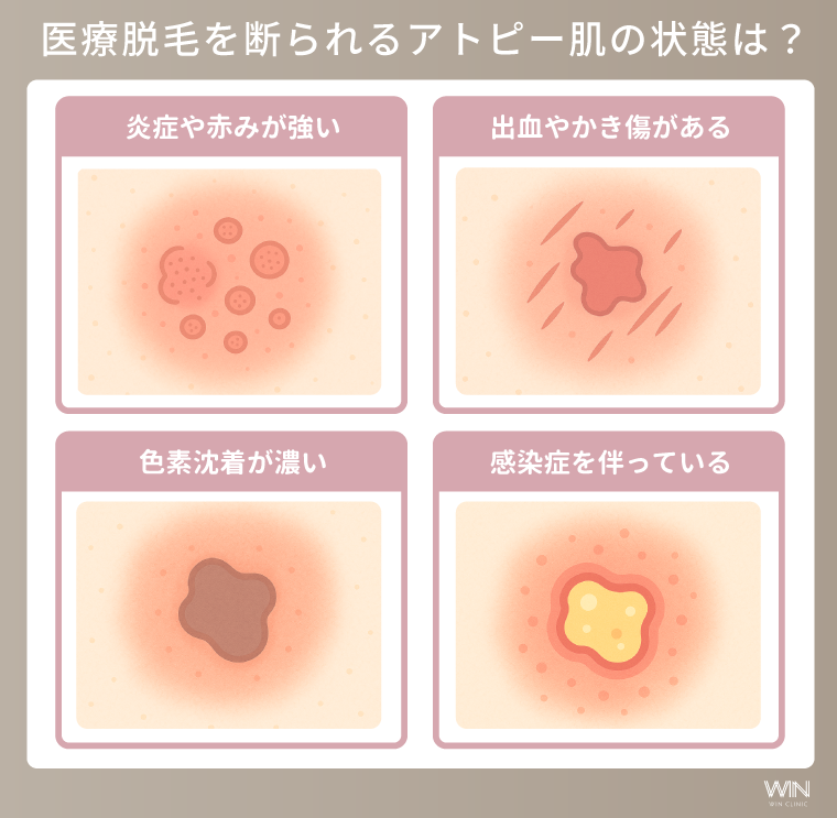 医療脱毛を断られるアトピー肌の状態は?