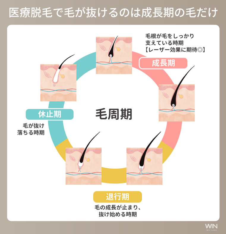 医療脱毛で毛が抜けるのは成長期の毛だけ